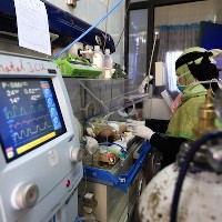 В Йемене скончались новорожденные сиамские близнецы